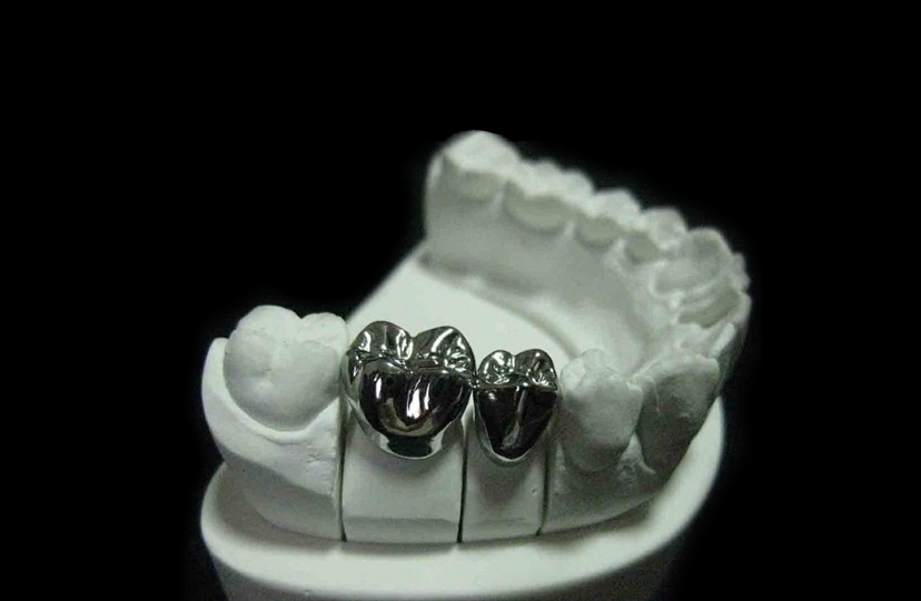 Base Metal (Non-Precious) Full Cast Crowns